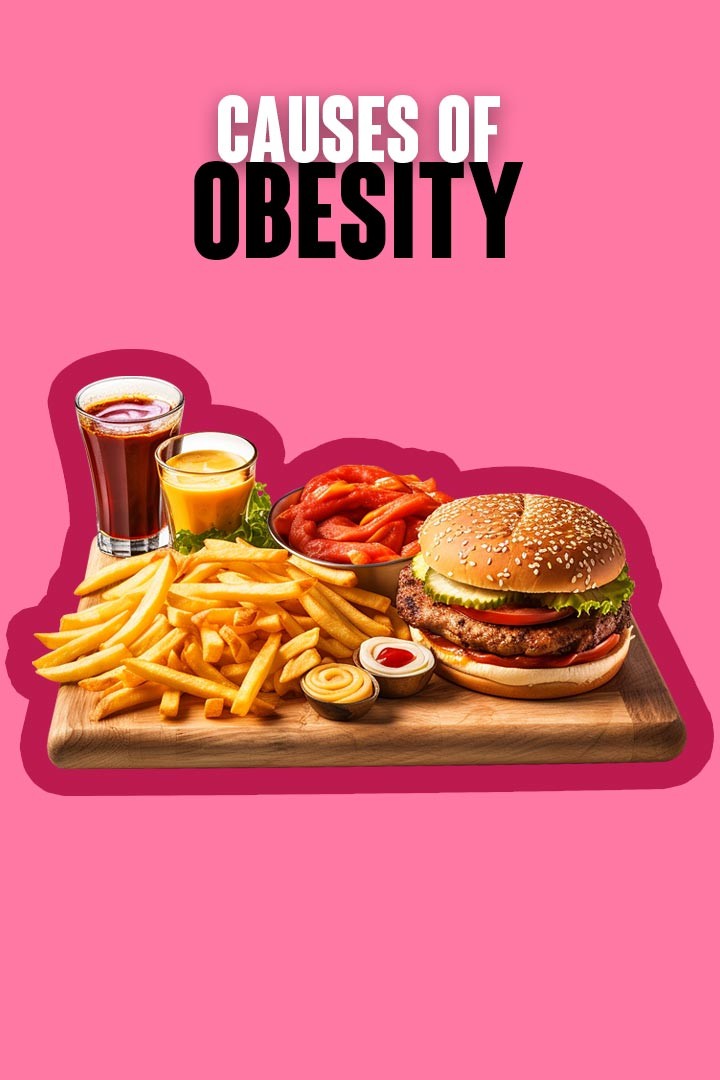Causes of Obesity