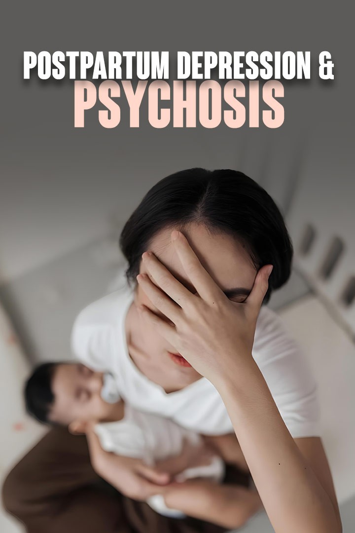 Postpartum Depression & Postpartum Psychosis with Dr. Anjali